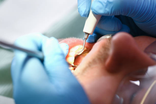 Best Emergency Treatment for Toothache in West Hattiesburg, MS