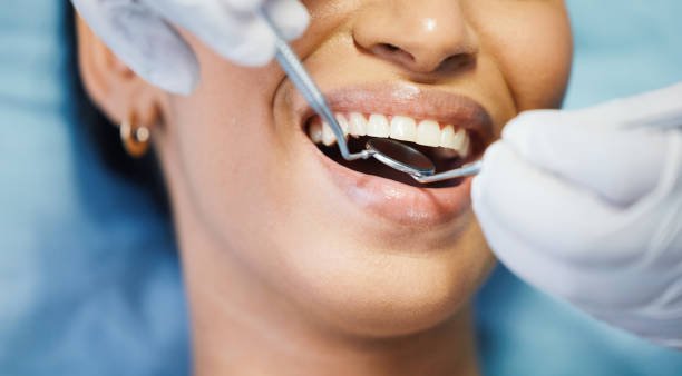 Best Emergency Root Canal Treatment in West Hattiesburg, MS