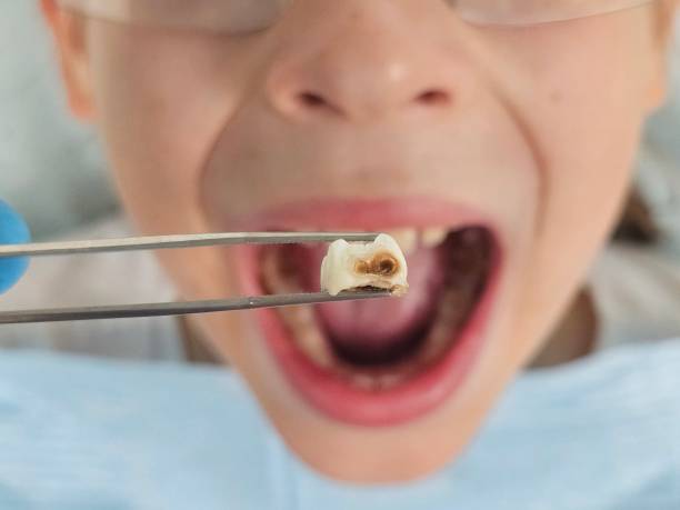 Best Weekend Emergency Dentist in West Hattiesburg, MS