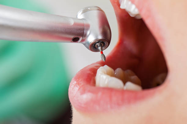 Best Emergency Broken Tooth Repair in West Hattiesburg, MS